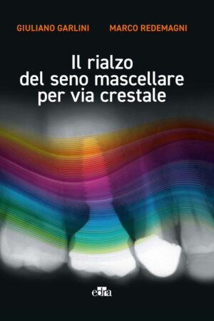 IL RIALZO DEL SENO MASCELLARE PER VIA CRESTALE